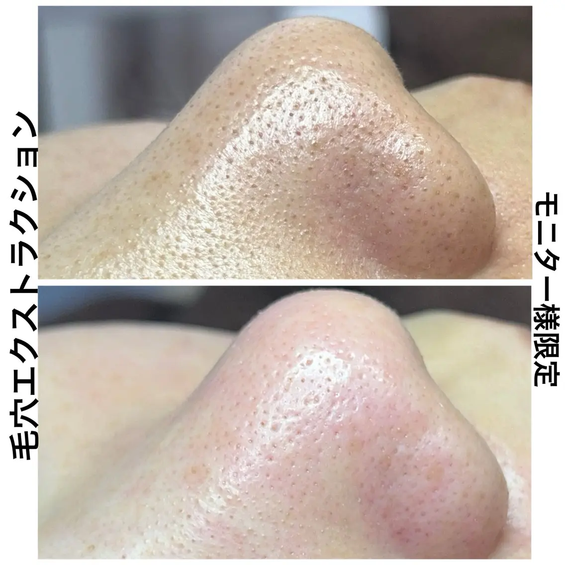 エステ Muqu. 毛穴サロンのエステ・リラクイメージ