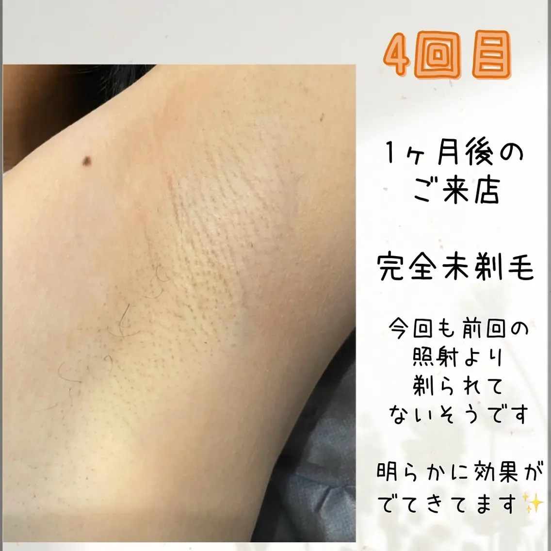 脱毛 脱毛&リラク FIS福岡薬院店のエステ・リラクイメージ