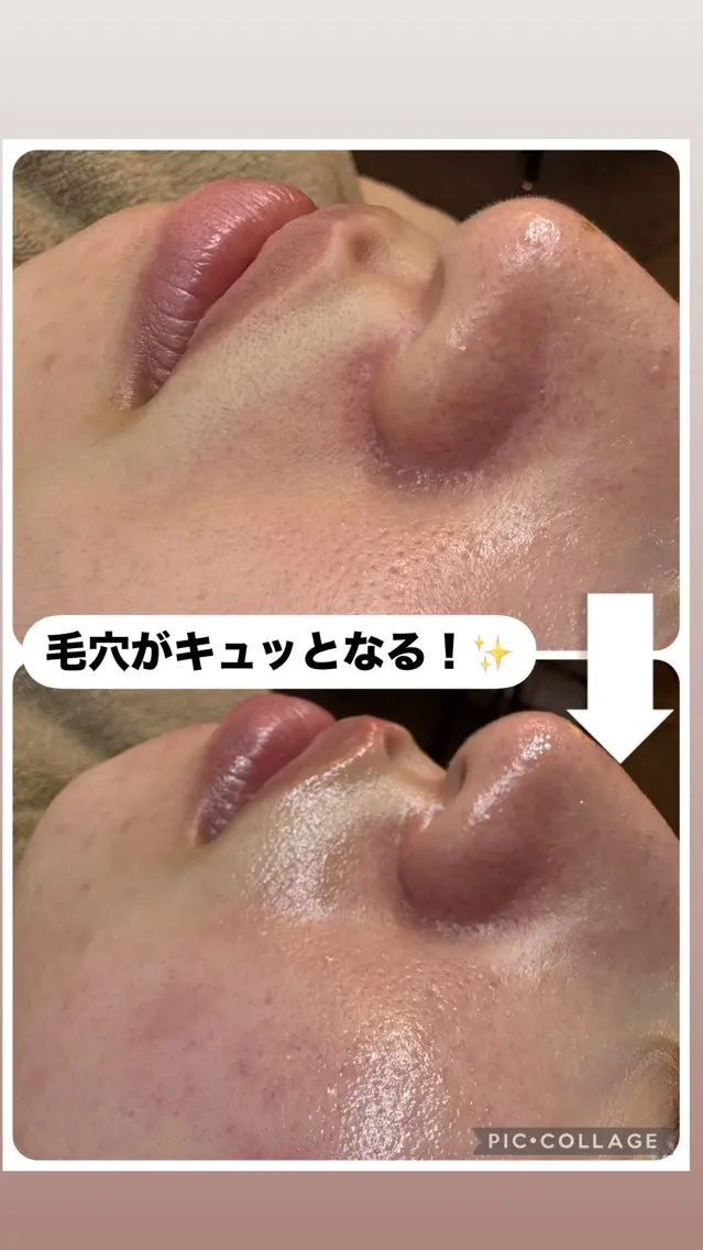 W MISATOのエステ・リラクイメージ