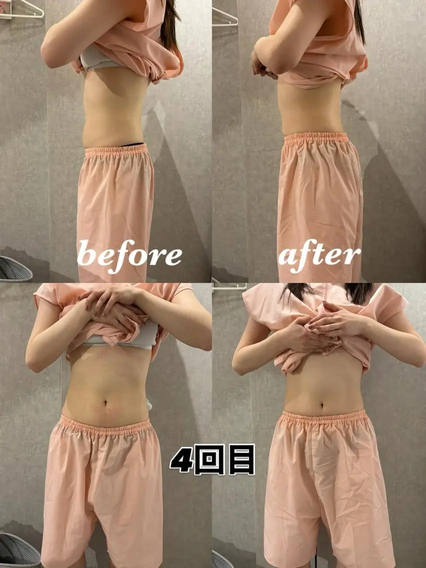 メンズ 腸活サポート みなみののエステ・リラクイメージ