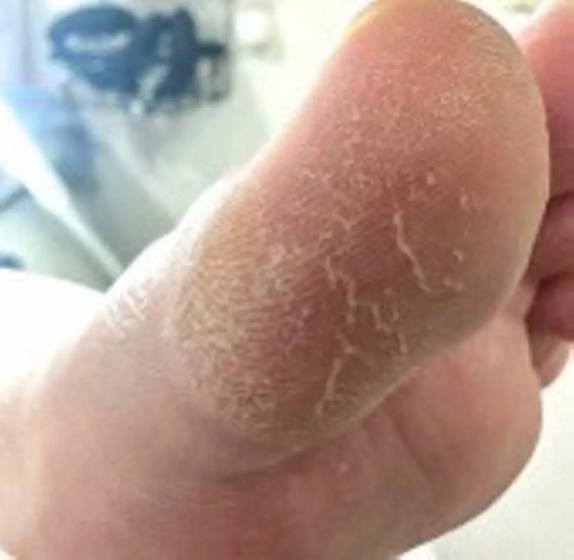 角質ケア【フットバス付き】足裏つるつる1hコースの写真