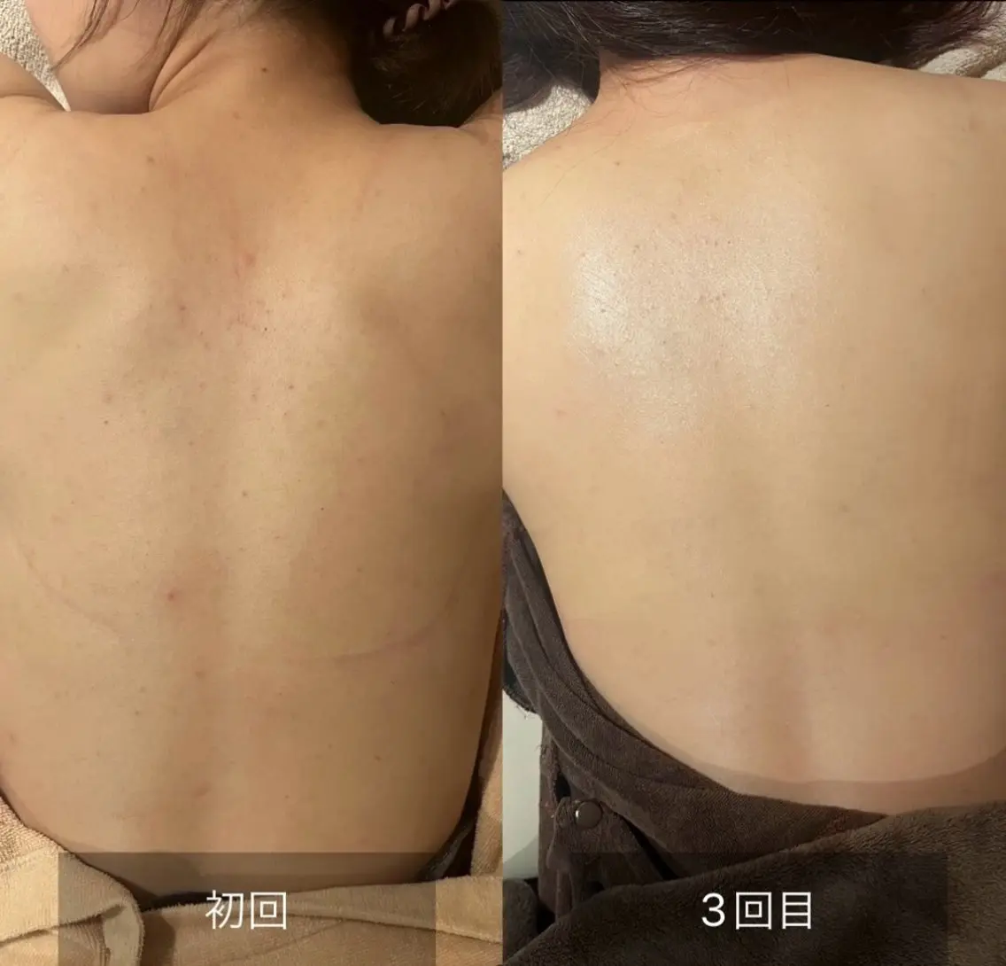 その他 森 美優のエステ・リラクイメージ