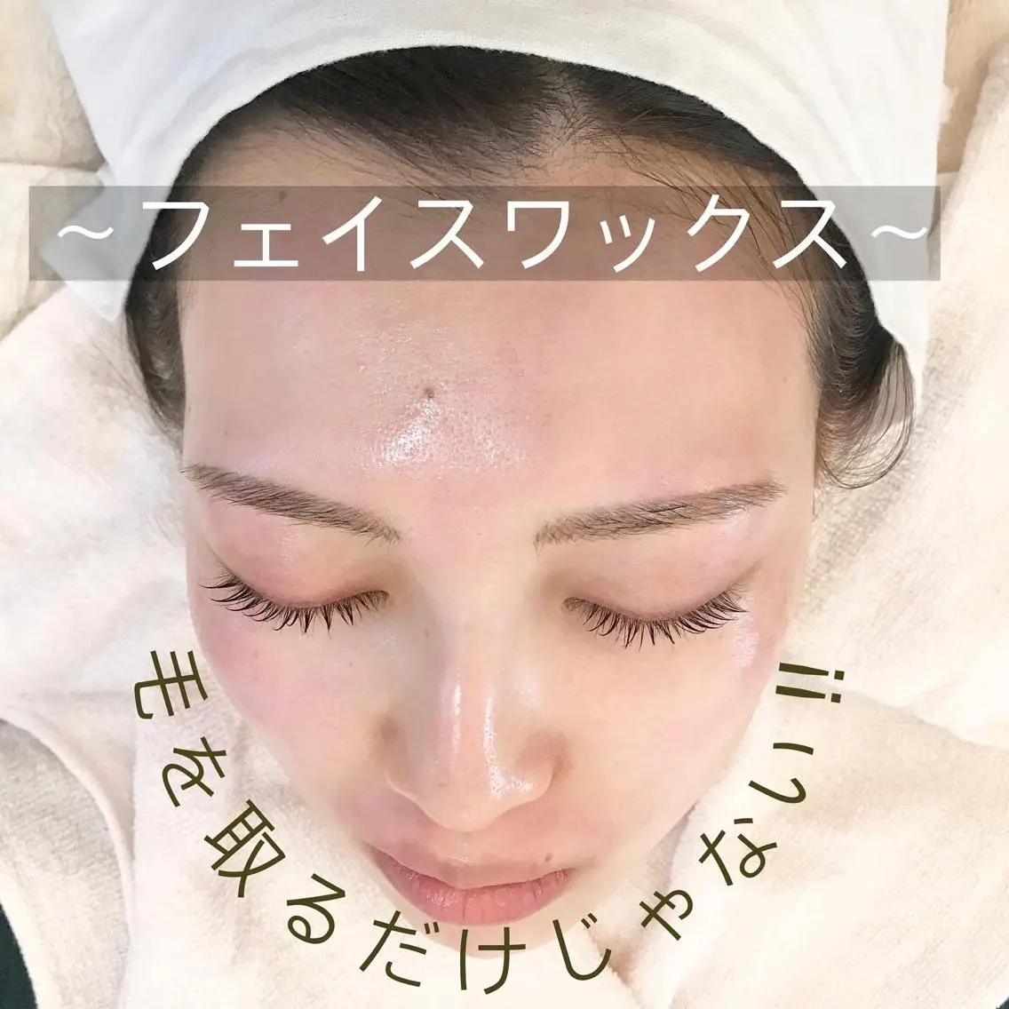 【お顔】お顔ワックス　パックつき♡ 産毛も根こそぎゴッソリでアップ⤴︎⤴︎の写真