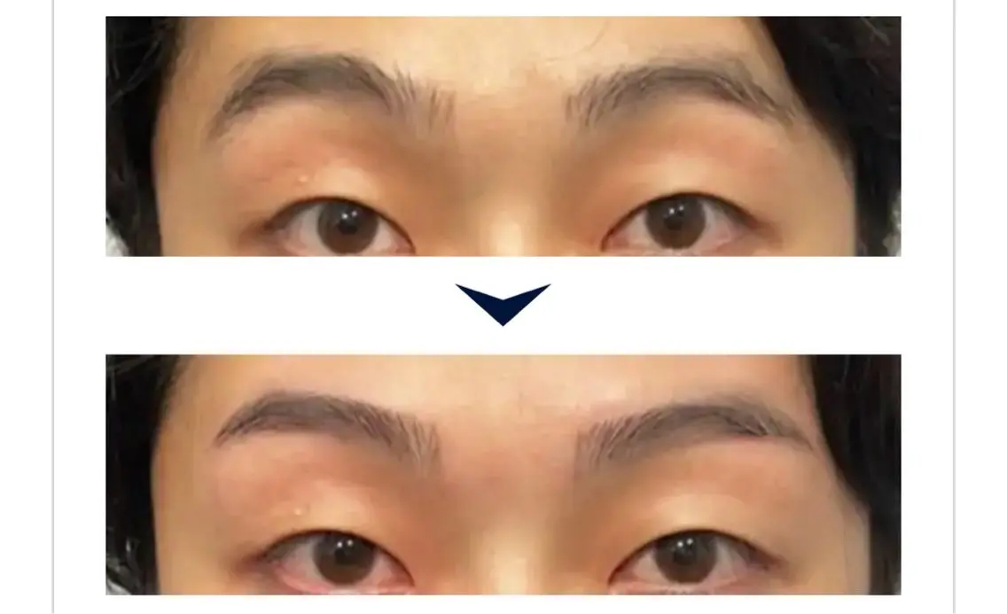 【メンズ🚹限定】眉スタイリング(ワックス脱毛)の写真