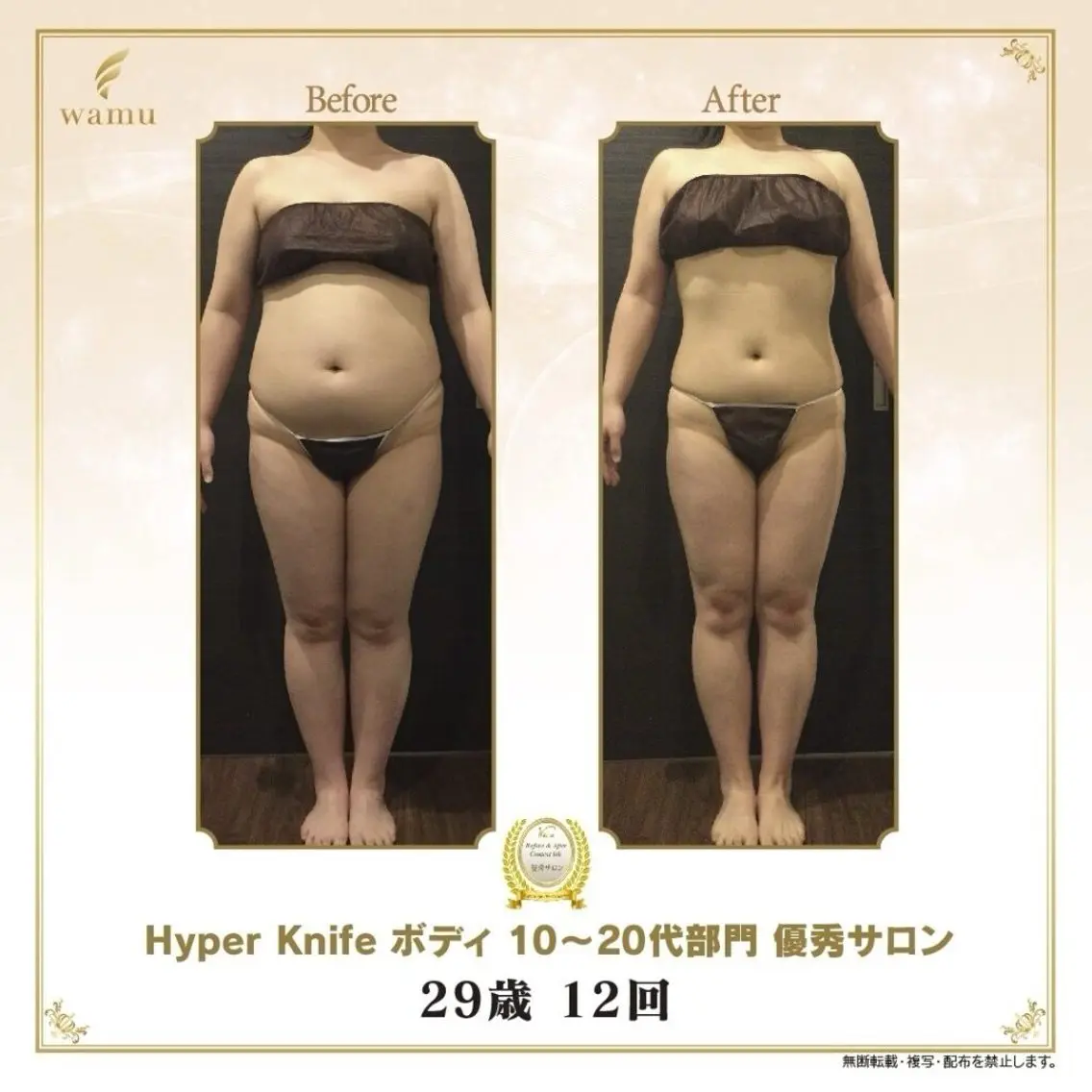 ≪特価★美脚美尻集中≫ハイパーナイフ+リンパマッサージ60分¥13000→ ¥6800の写真