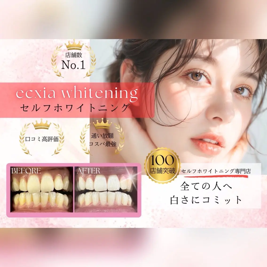 【ミニモ限定✨】セルフホワイトニング(9分×２セット)1回¥3980→¥500 別途料金なし◎の写真