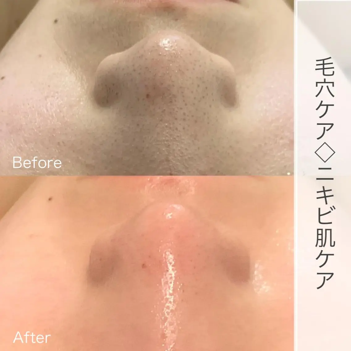 脱毛&ビューティー A'nJUDYの眉毛・アイブロウイメージ