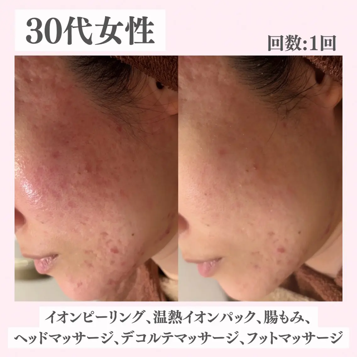 エステ リラク ニキビ・肌質改善専門 ♡人生が変わるサロンのエステ・リラクイメージ
