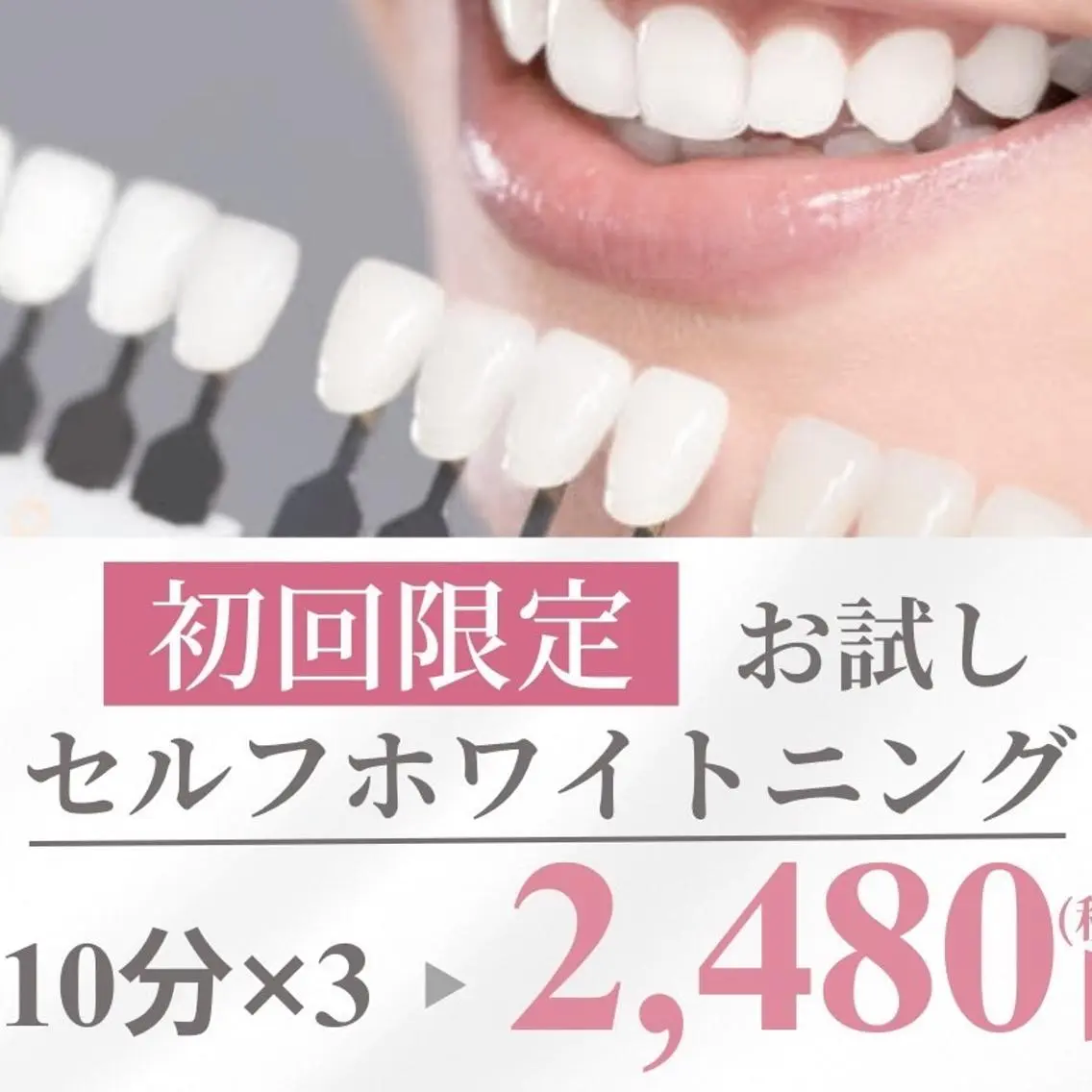 ホワイトニング専門店 LCS 銀座店 峰岡のその他イメージ