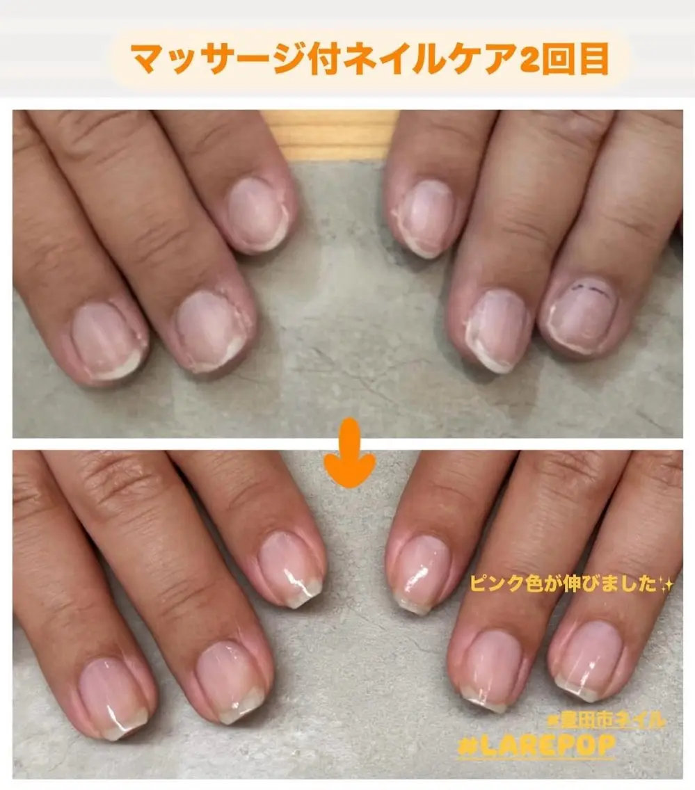ハンドケアエステ美容液導入、甘皮処理、自爪カット、整え、マッサージ付の写真