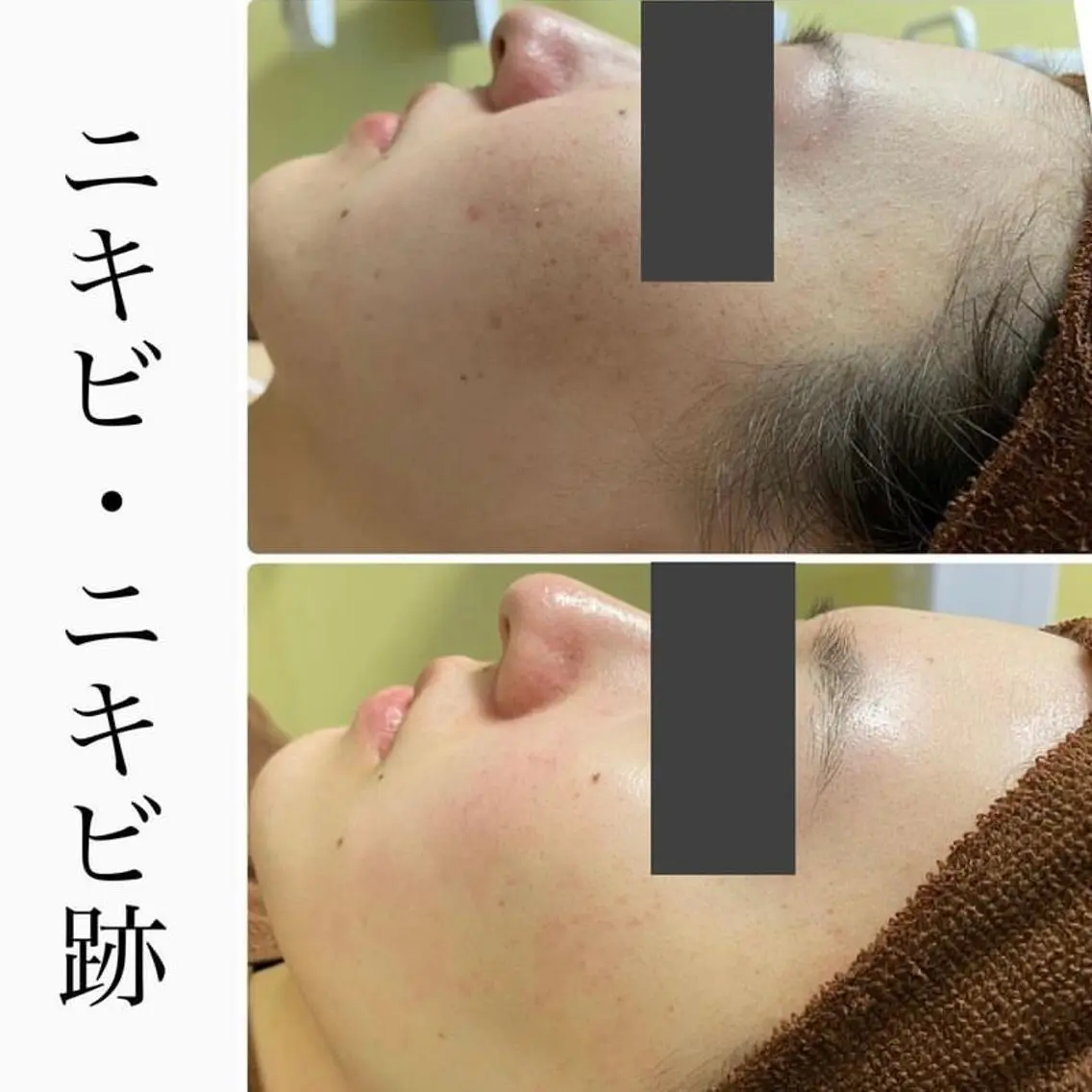 ハーブピーリング専門 BIOPLUS+川崎のエステ・リラクイメージ