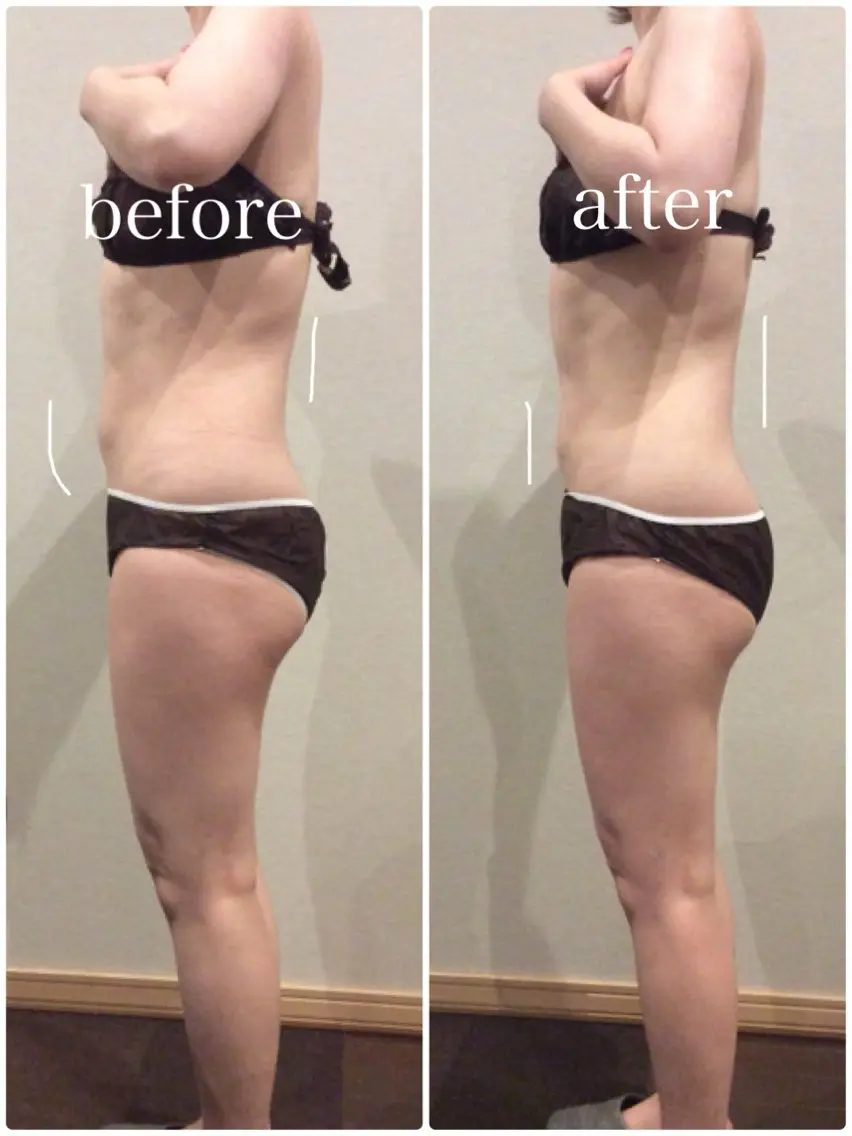 計120分　［眠りが浅い方へ］腸タイプカウンセリング30分＋オーダーメイド腸もみ90分の写真