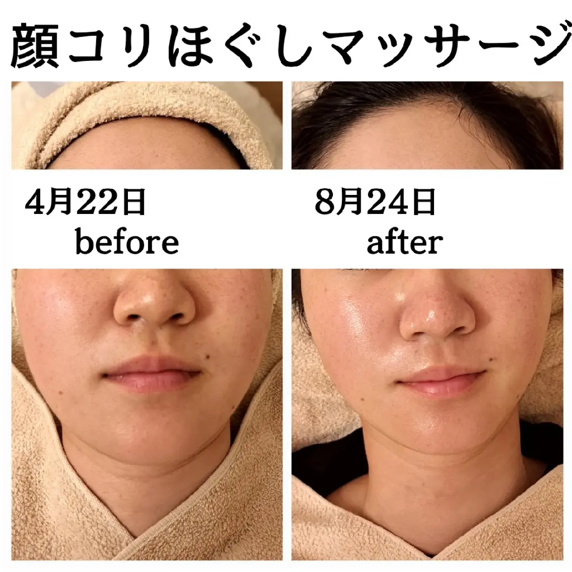 エステ フェイシャル専門サロ ン　ERINのエステ・リラクイメージ