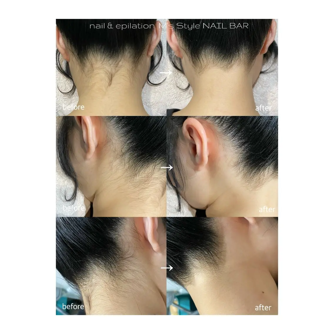 脱毛 M's Style NAIL BARのネイルデザイン
