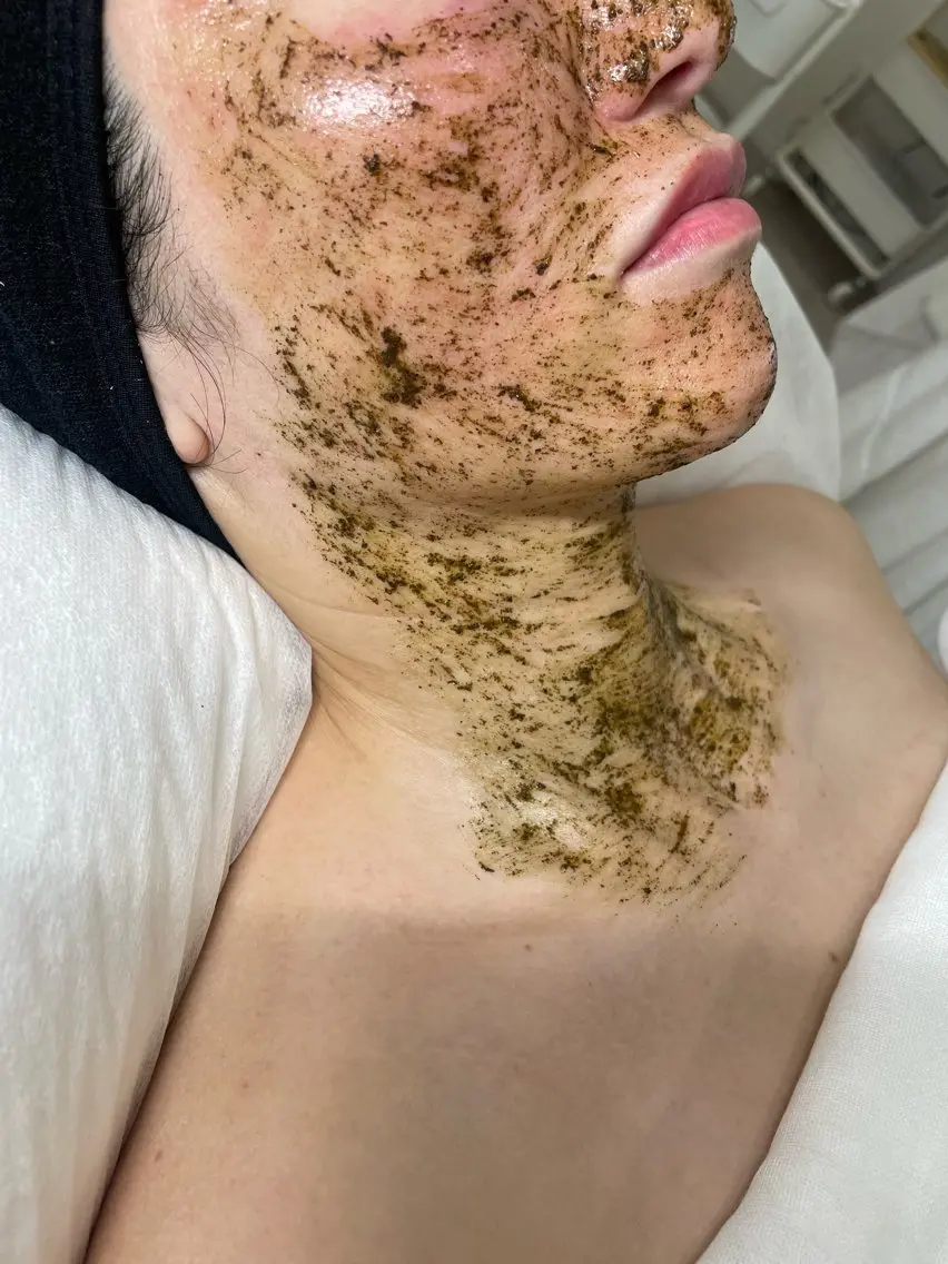 お悩み別ハーブリプロ（剥離あり）の写真