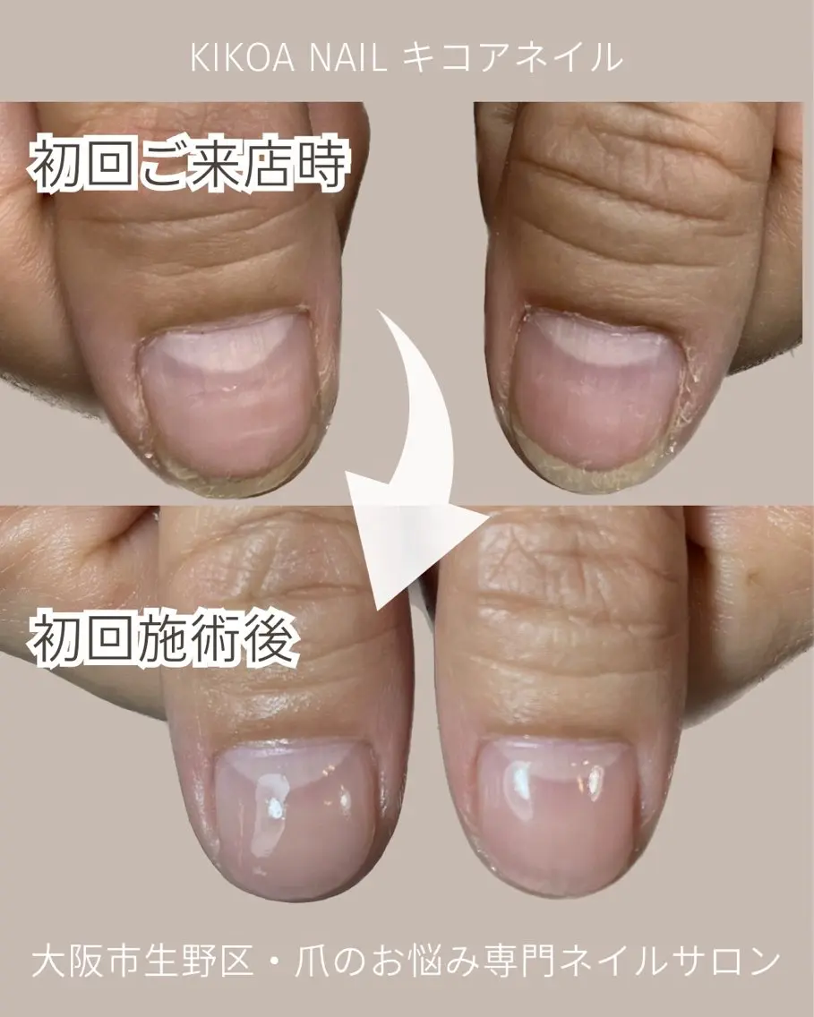ネイル KIKOA NAIL キコアネイルのネイルデザイン