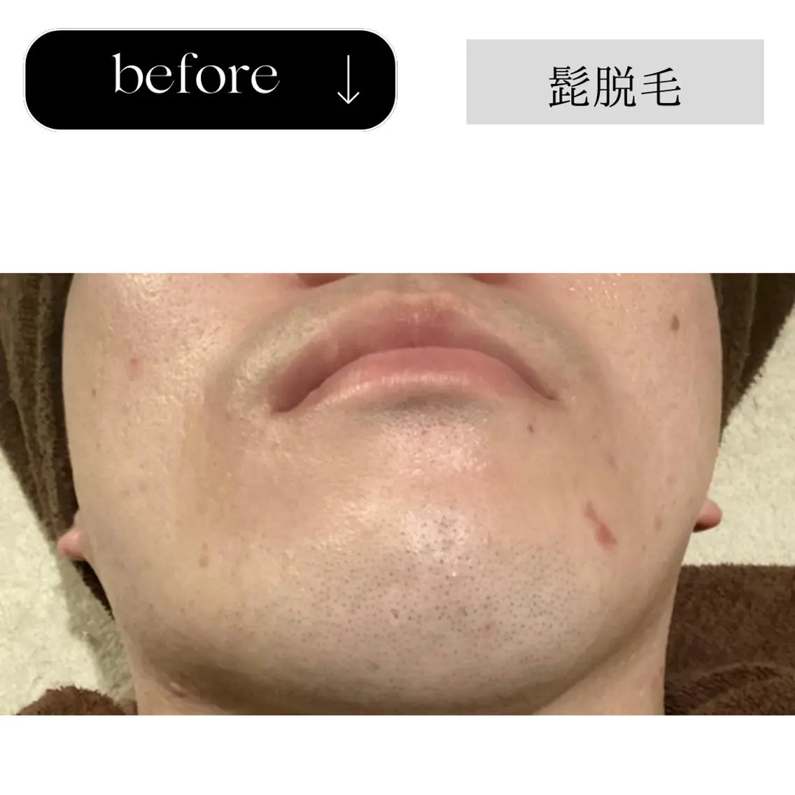 脱毛 beauty CHOOSEのエステ・リラクイメージ