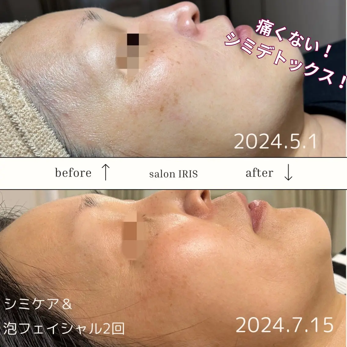 エステ ASAI CHIZURUのエステ・リラクイメージ