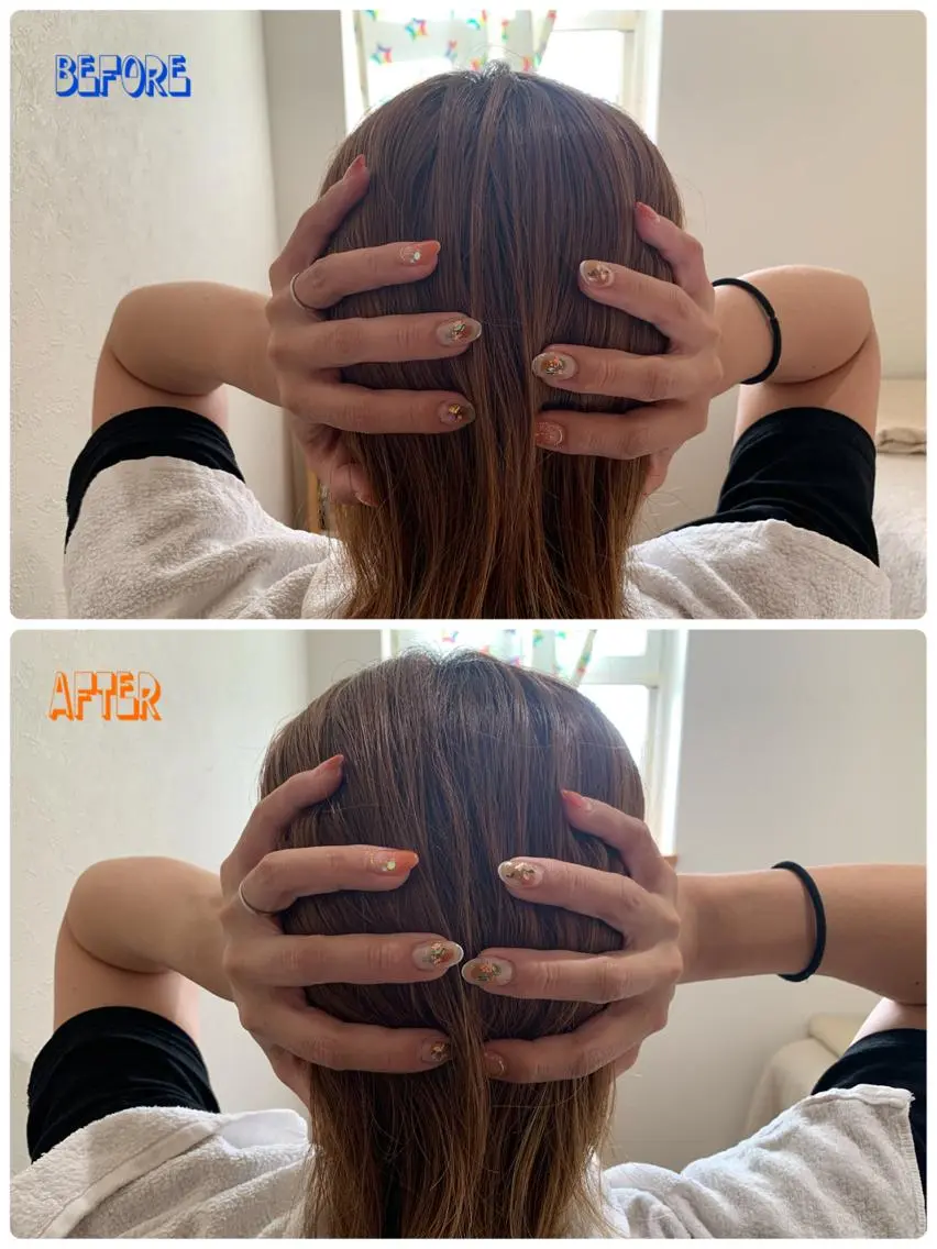 浮腫み解消ヘッドスパの写真
