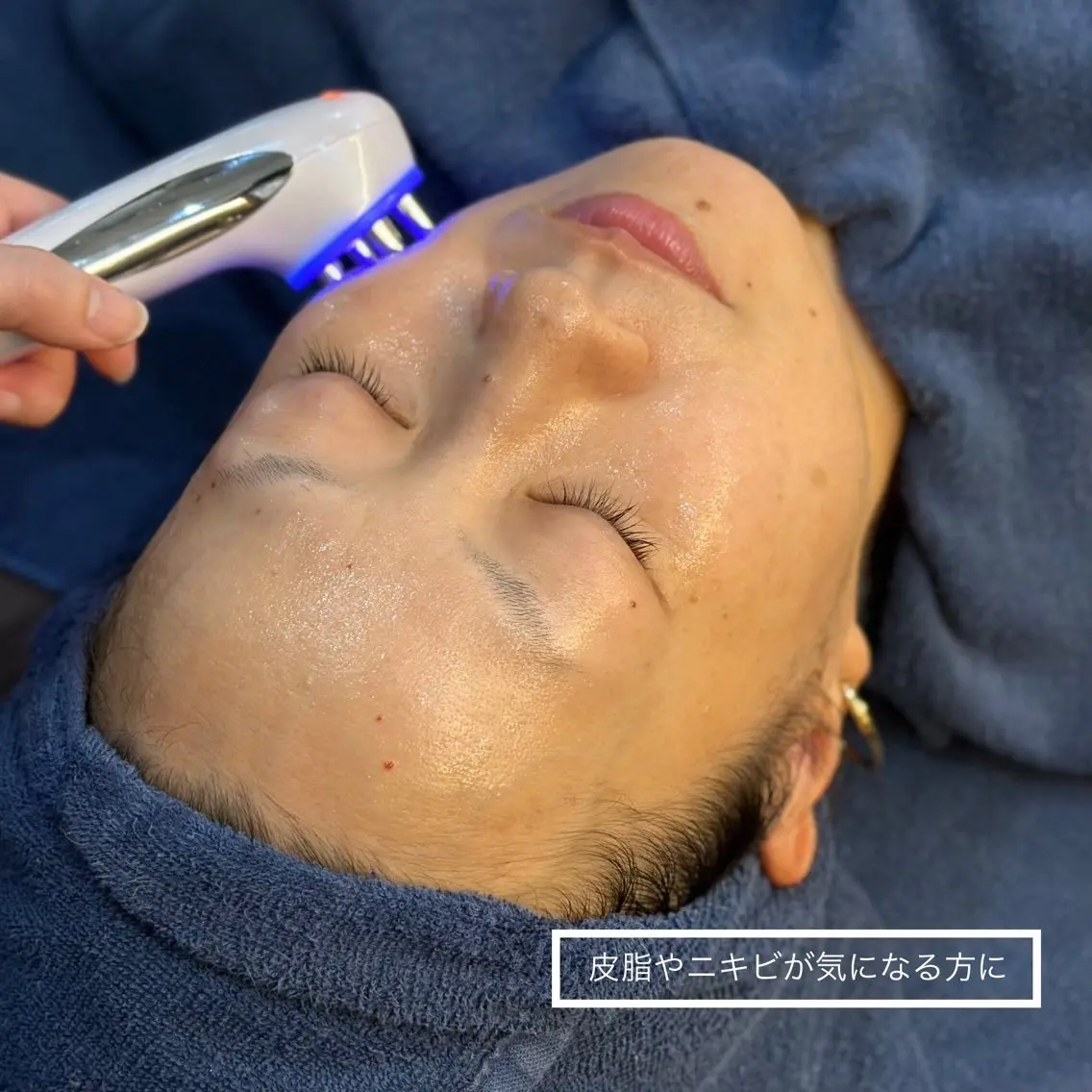 leolo武蔵浦和 肌質改善&脱毛のエステ・リラクイメージ