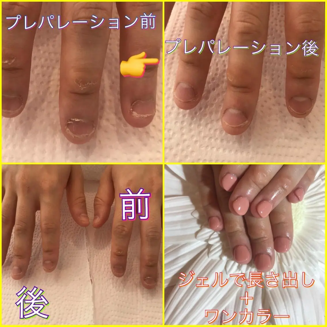 ネイル ジェルネイル スカルプネイル ♢ME2ROOM♢ #巻き爪#リラクのネイルデザイン