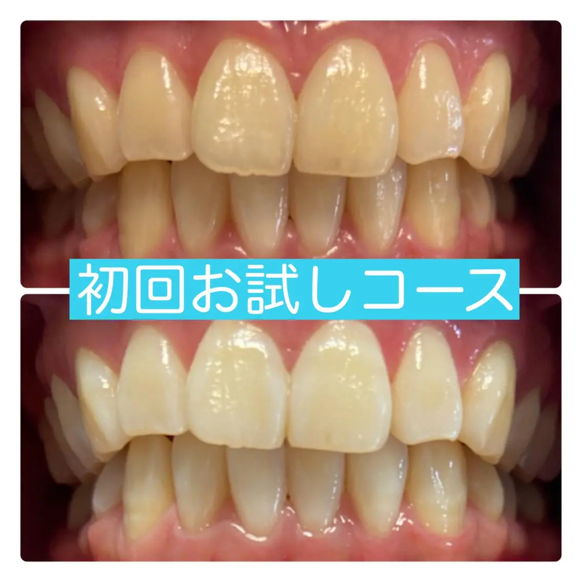 その他 ホワイトニングルーム 横浜店のその他イメージ