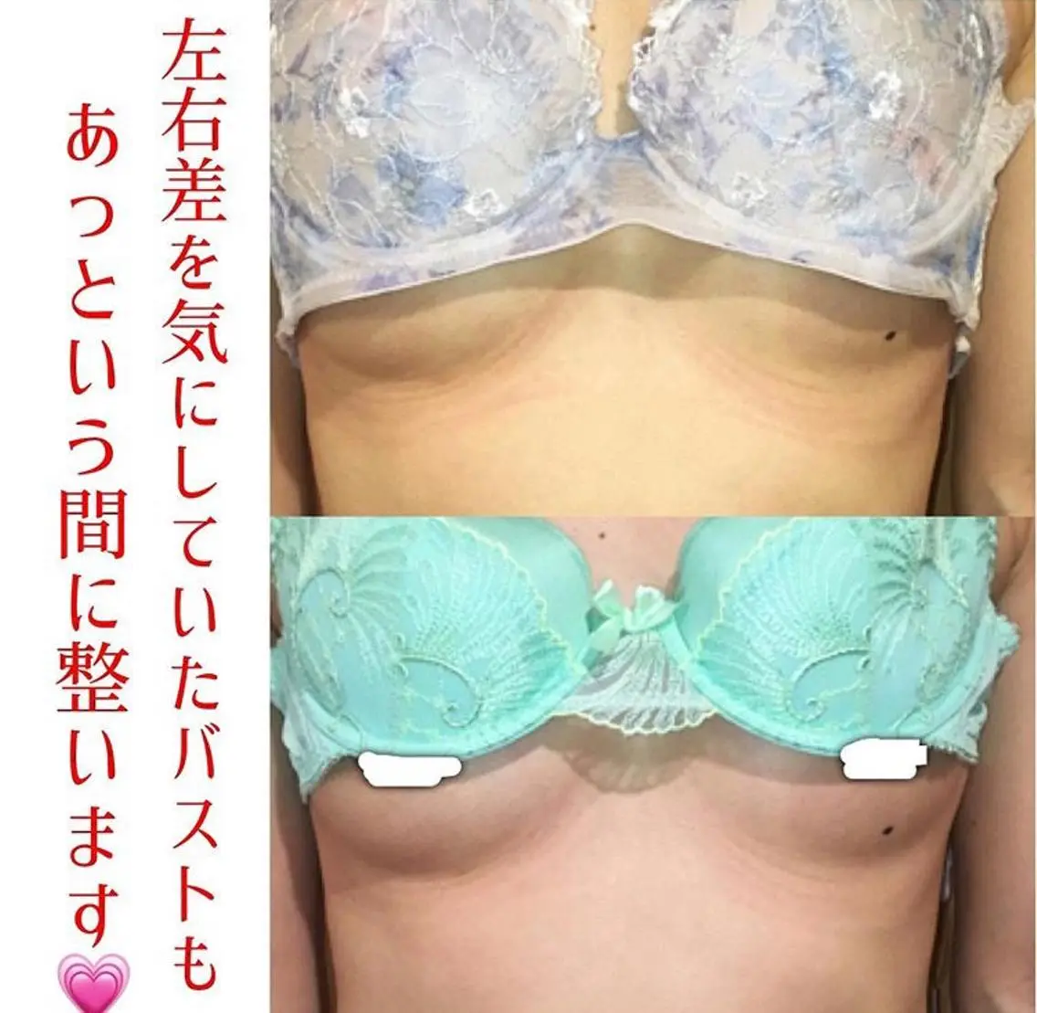 人気NO1.☆ボリュームアップ・弾力アップ とにかくバストを変えたい方！！ 通常¥17,280→の写真