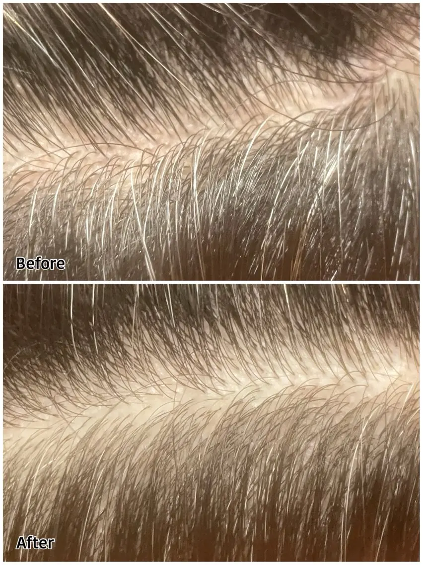 ヘッドキュア＋ドライの写真