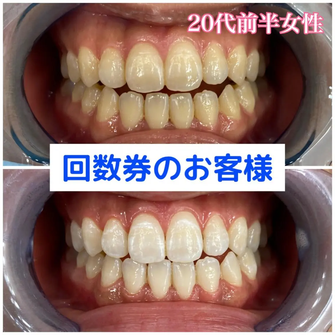 ホワイトニング専門店 吉田亮利のその他イメージ