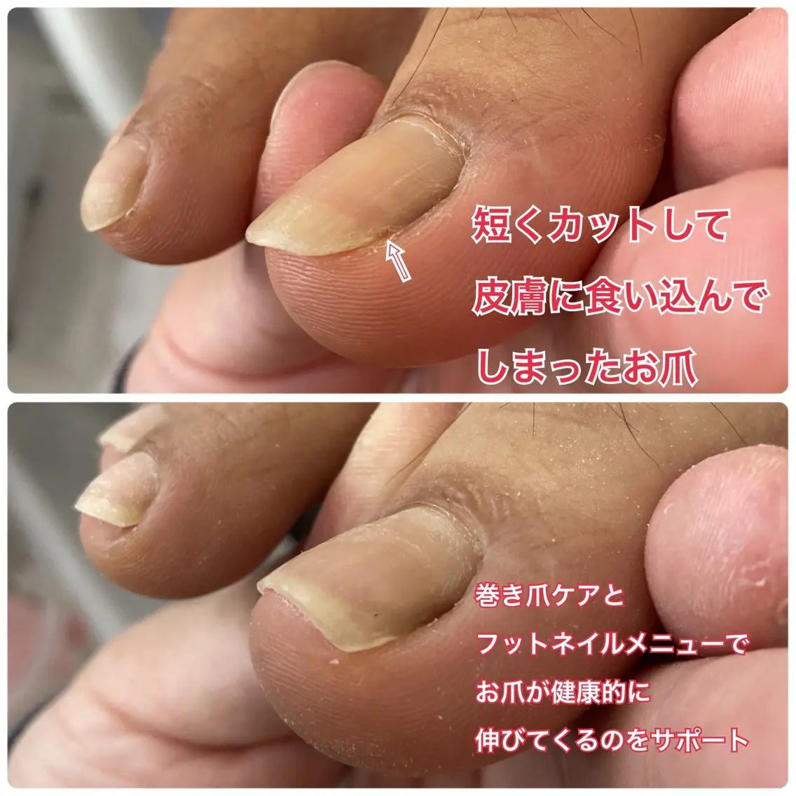 ネイル フットネイル Lotus Nailのネイルデザイン