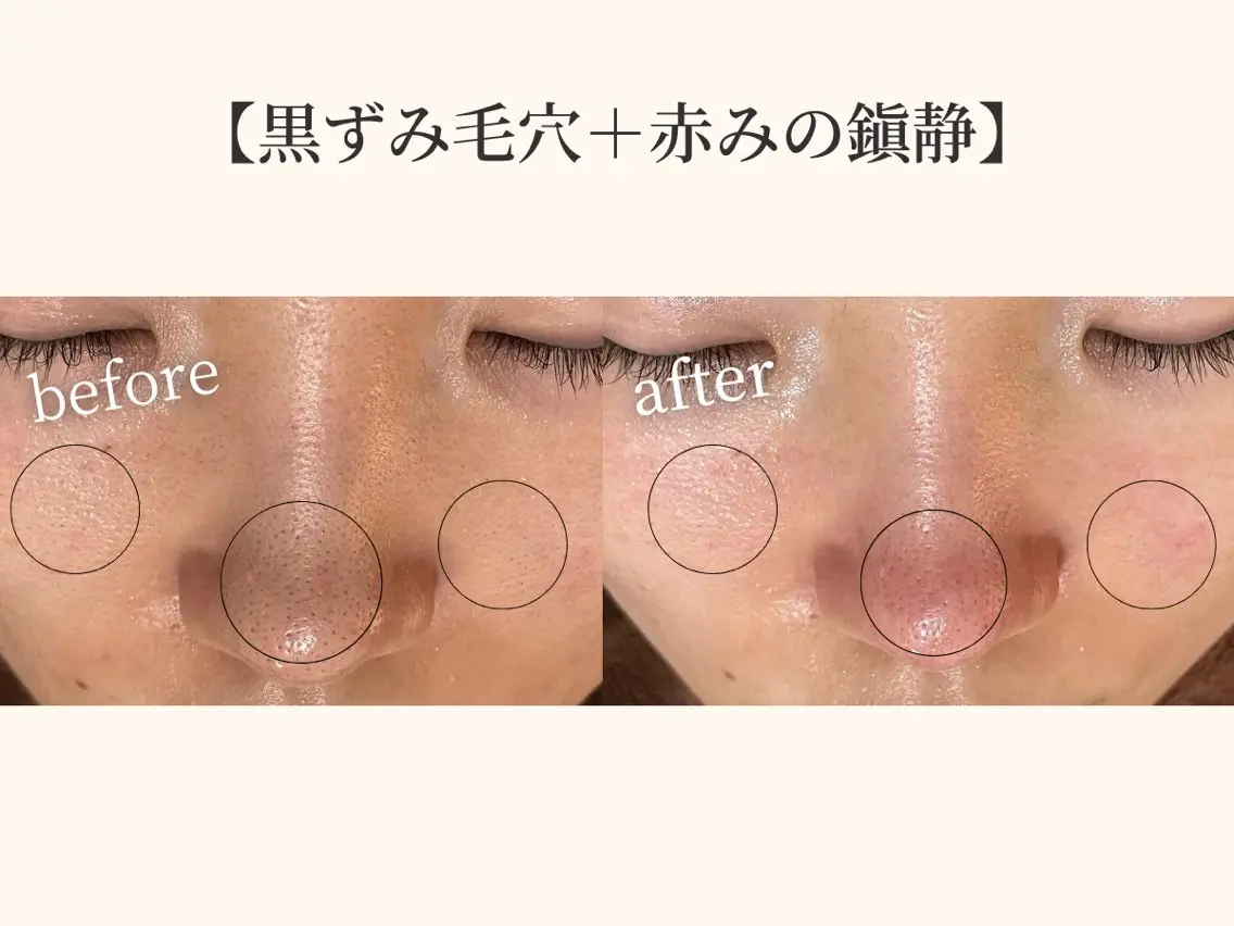 小顔矯正×毛穴サロン DRRAMSPA町田のエステ・リラクイメージ