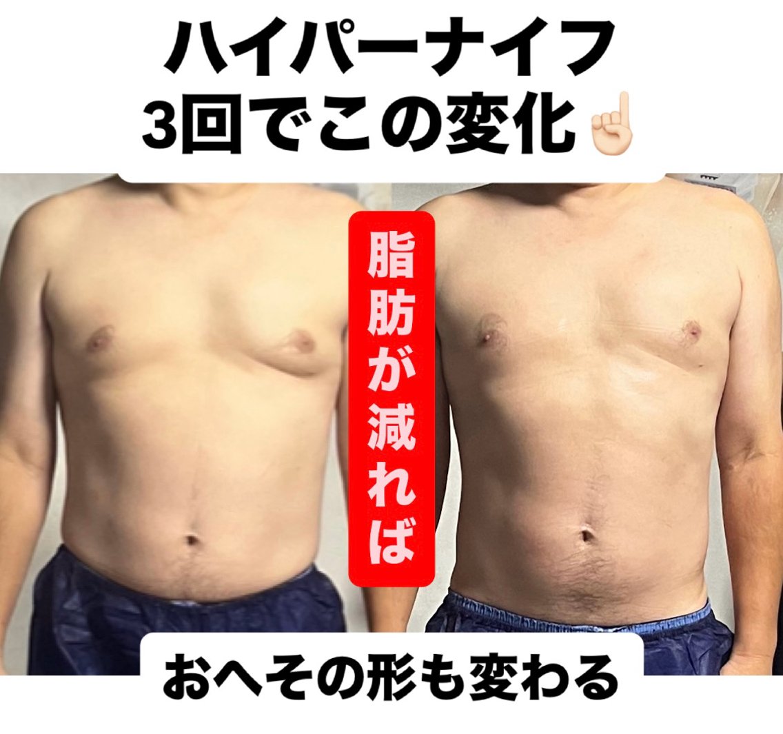 メンズ ハイパーナイフ専門 熊田陽子のエステ・リラクイメージ