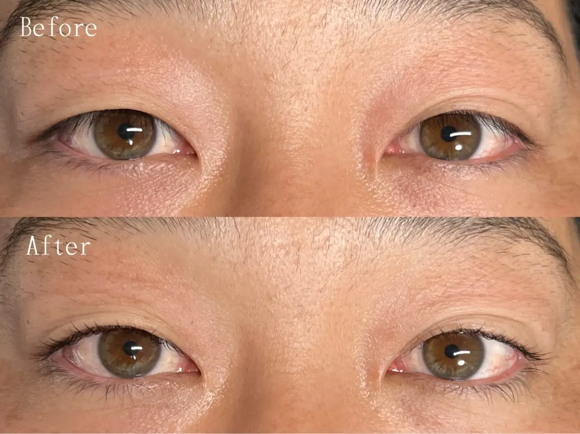 ＼逆まつげ解消‼️／メンズまつ毛パーマ【 視界良好👀✨ 】の写真