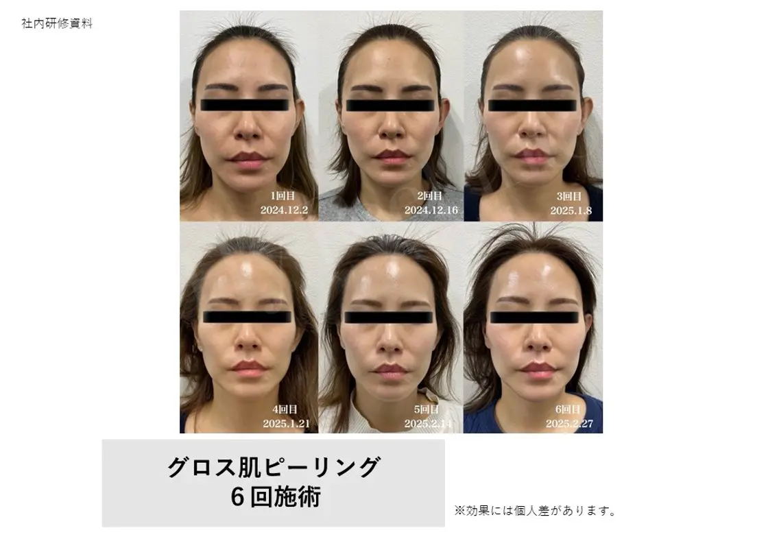 Bellvie かすみのエステ・リラクイメージ