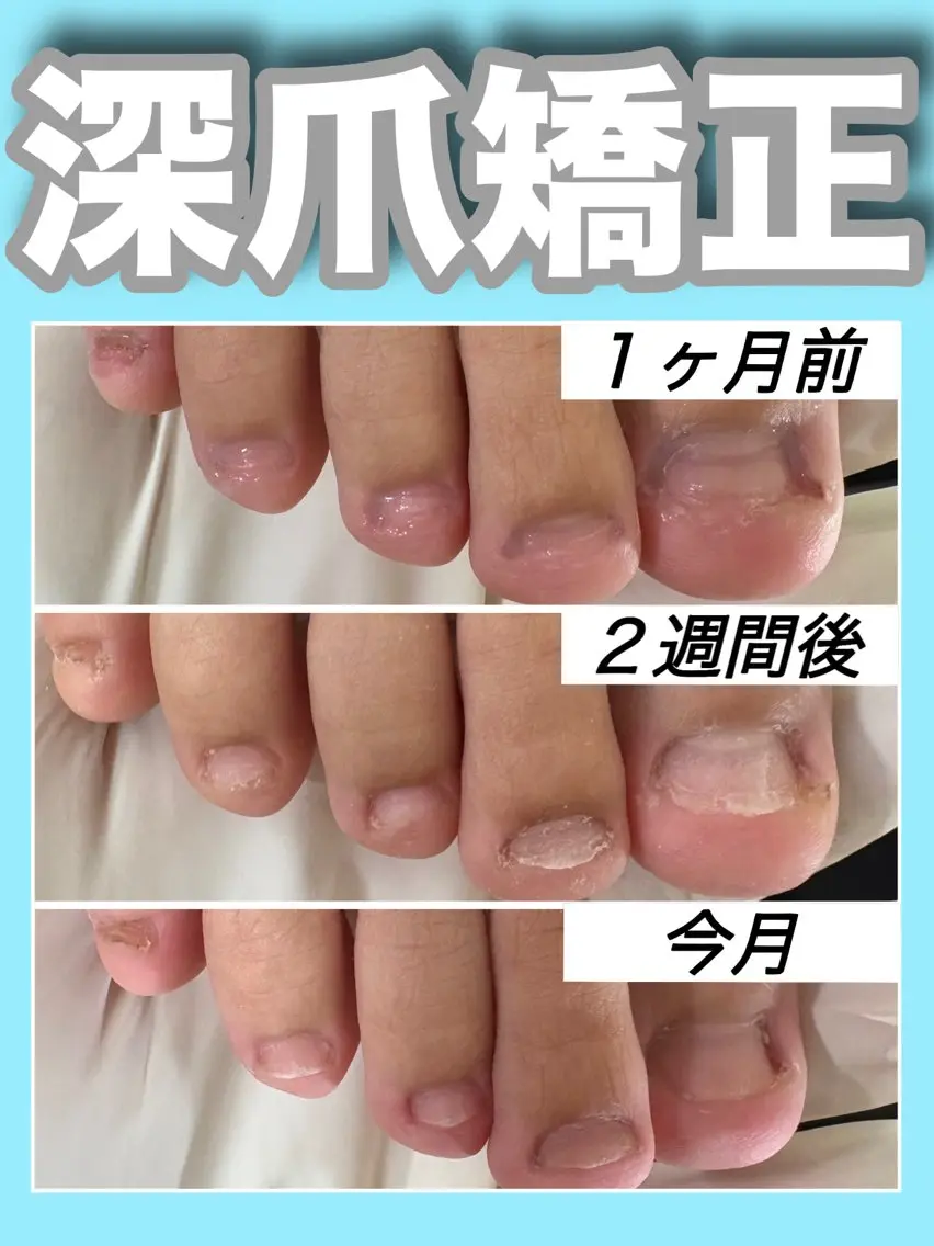 ネイル ジェルネイル 卒業式 フットネイル nail salon petillantのネイルデザイン