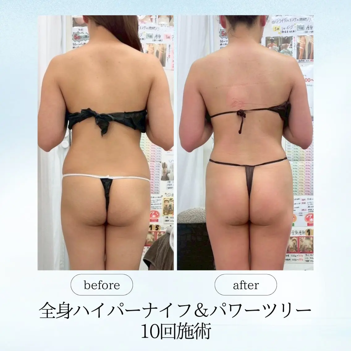 エステ リラク 《痩身、小顔専門店》 エスプレッソのエステ・リラクイメージ
