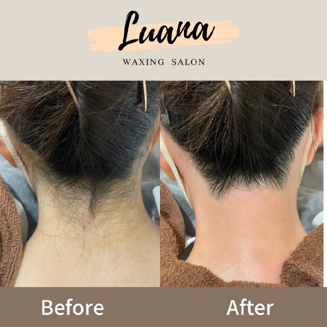 脱毛 Luana wax 🐚根本のエステ・リラクイメージ