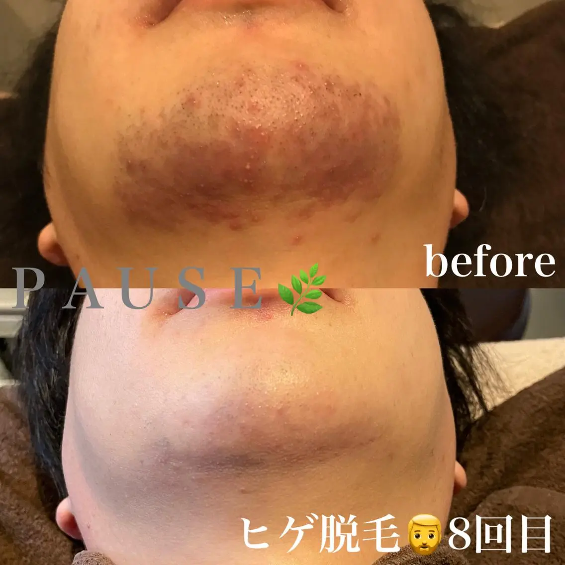 脱毛 浜野 恵美のエステ・リラクイメージ