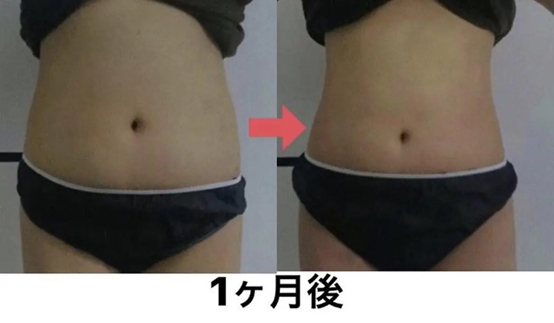 横浜エステサロン R-ing リングのエステ・リラクイメージ
