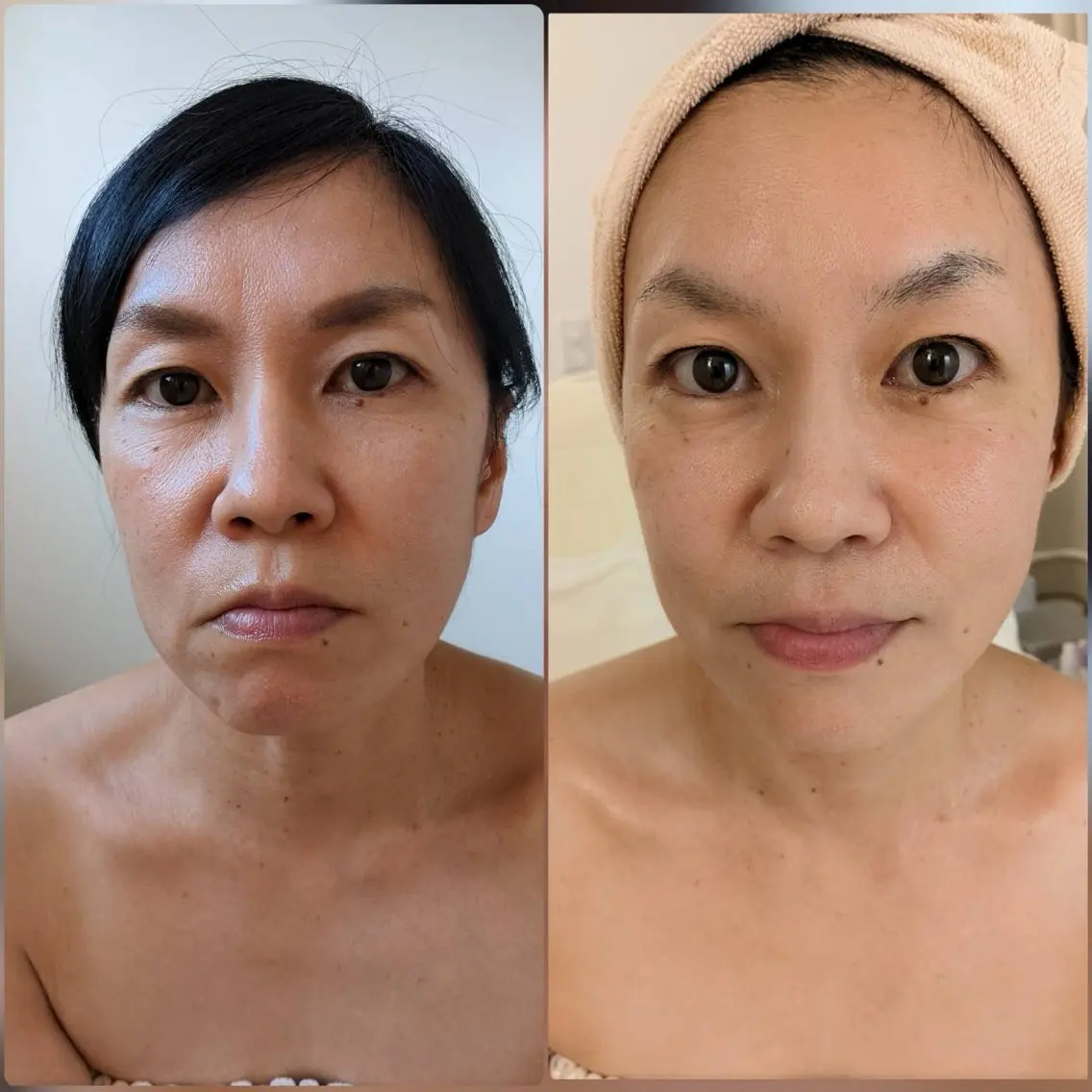 POLA The Beauty印場店のエステ・リラクイメージ