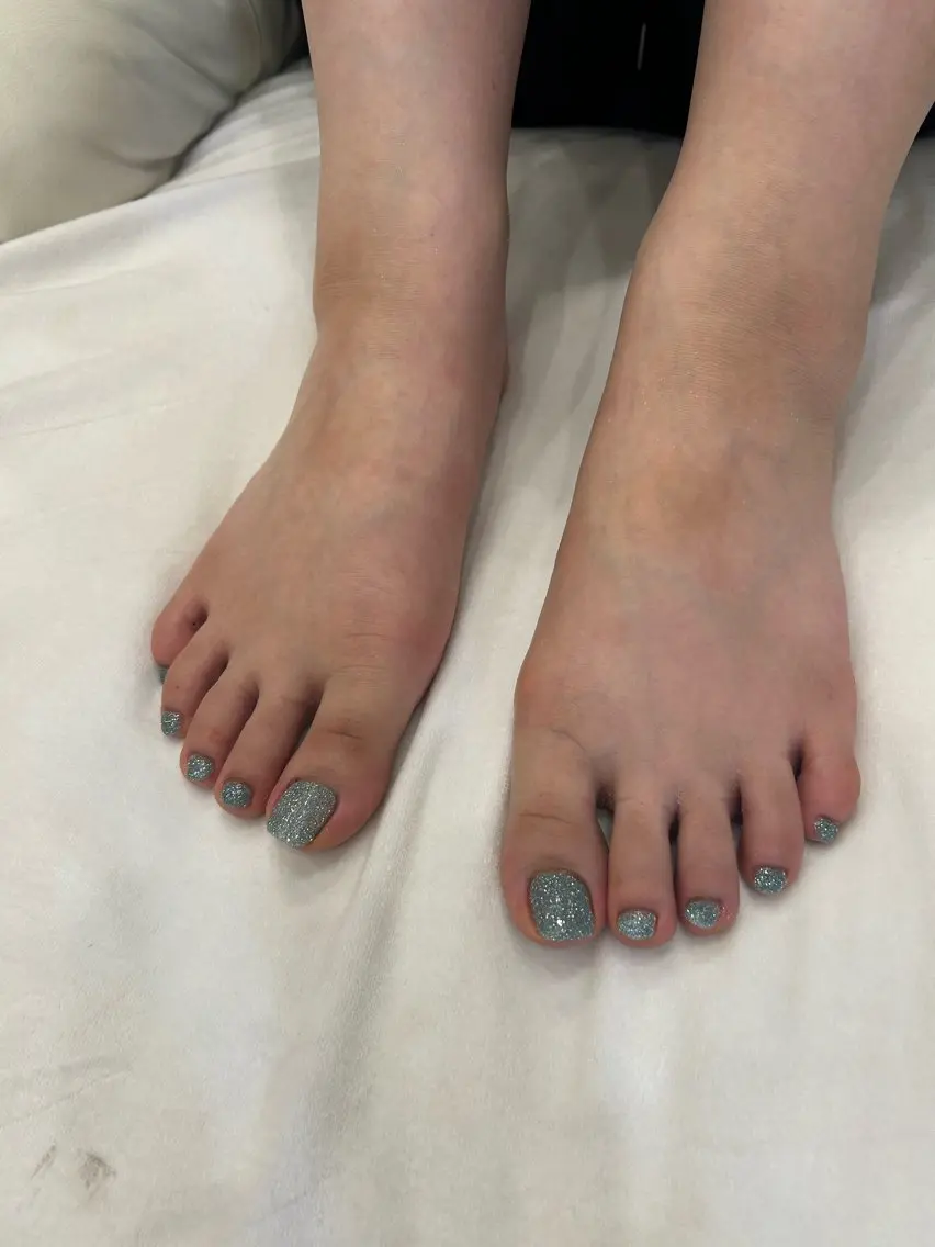 ネイル フットネイル 🎀 アネラ しま  🎀のネイルデザイン