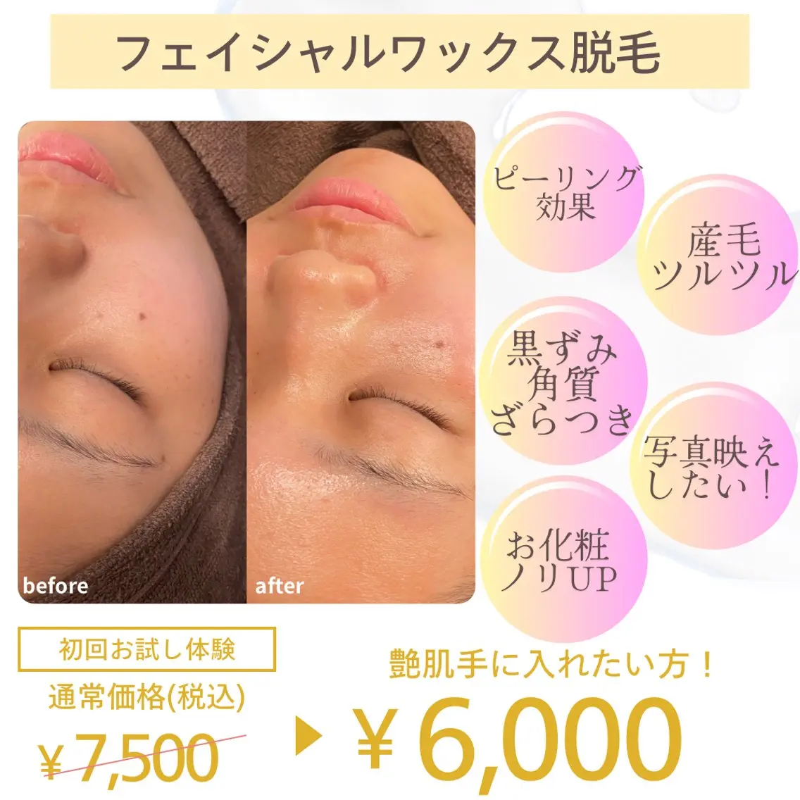 フェイシャル全顔ワックス✨産毛や角質ケアができピーリング効果◎お化粧ノリ・ツヤupで写真映え💖の写真