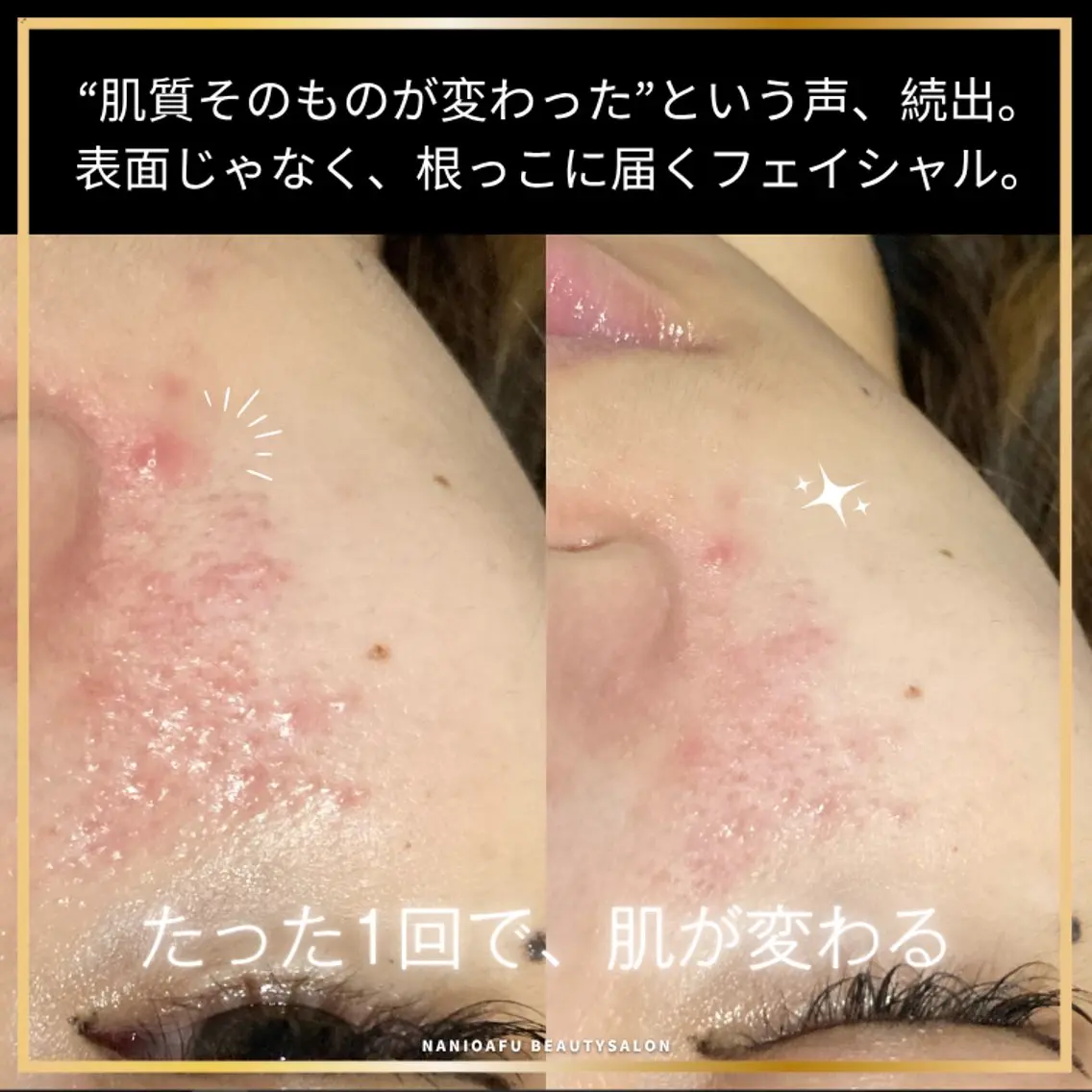 その他 NANIOAFU [本町店]のその他イメージ