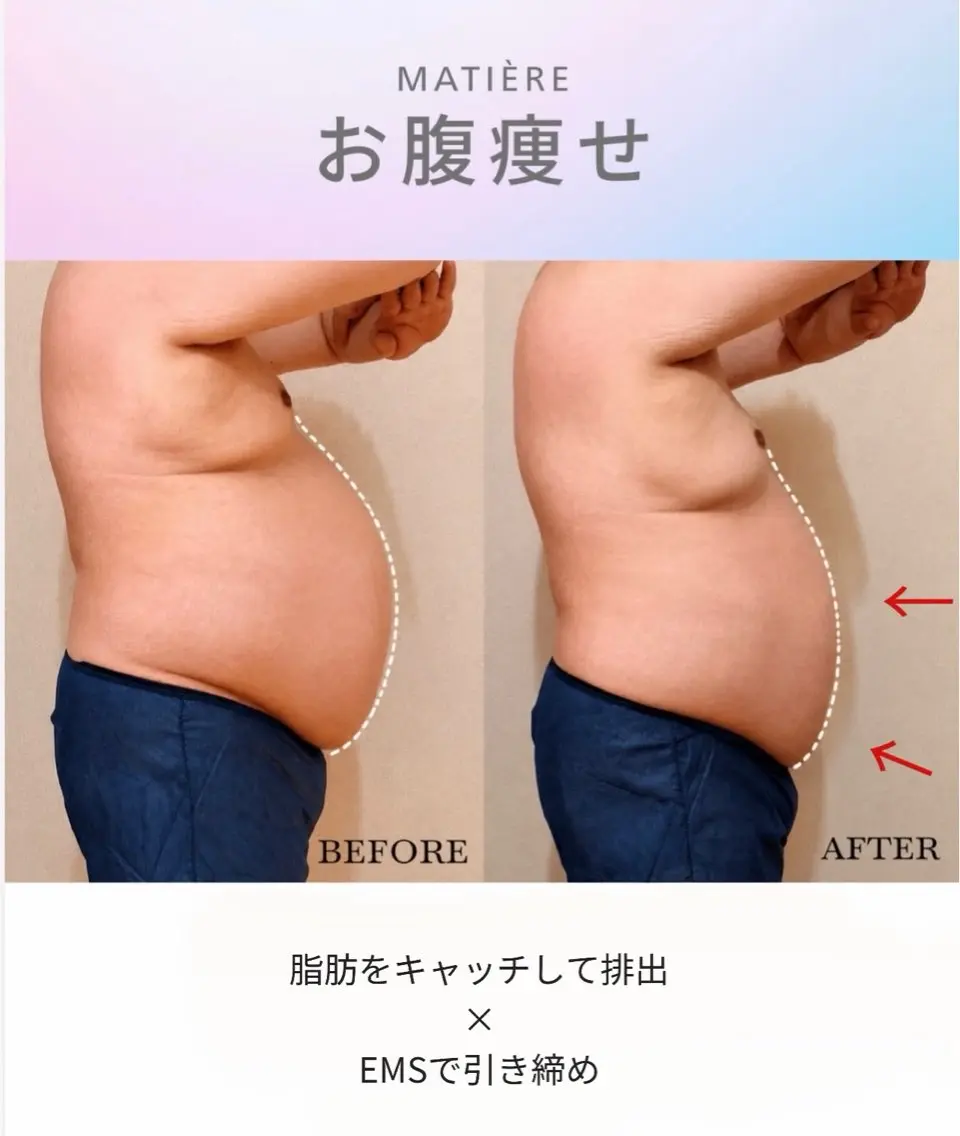 お腹スッキリ痩身!モニター✨️の写真