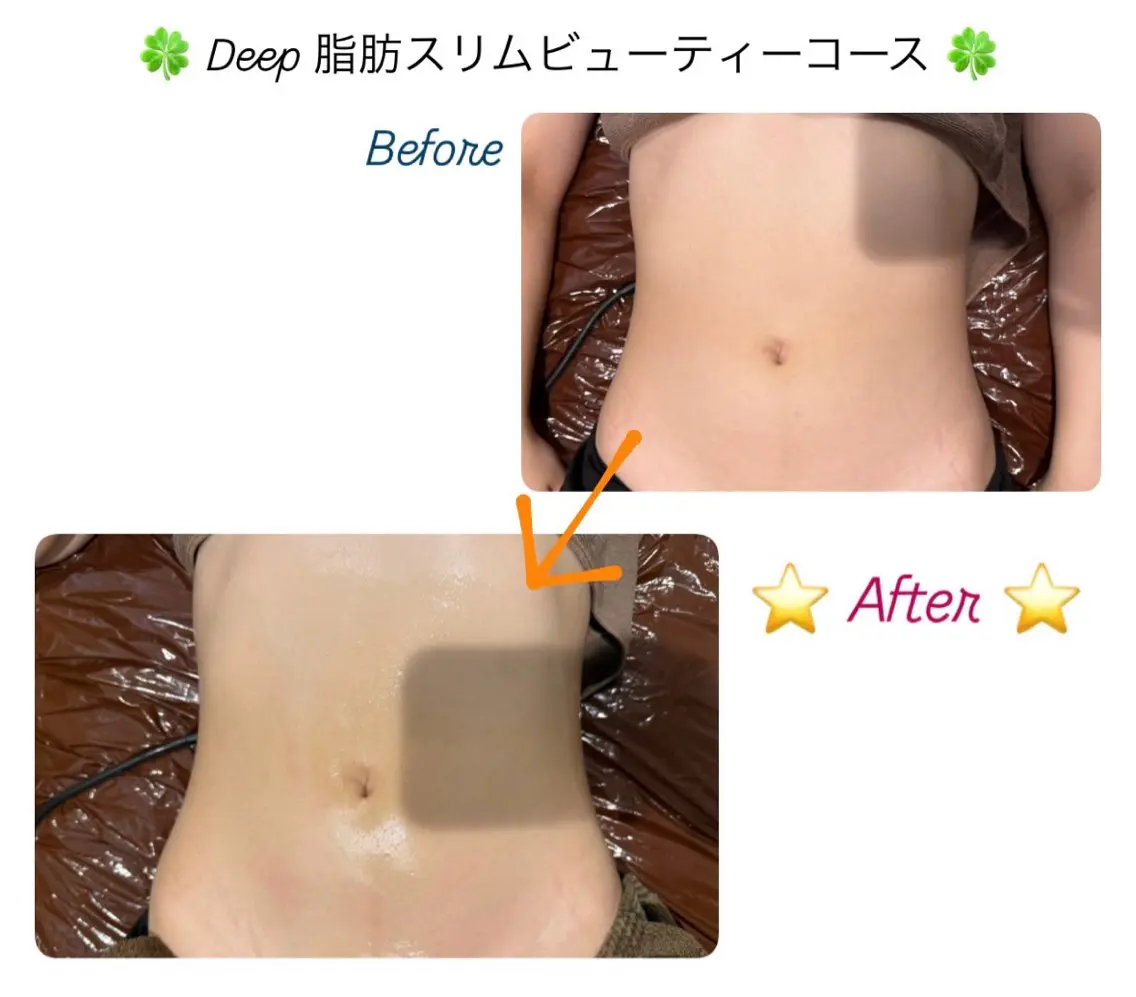 エステ ル プランタン 🌿 友唯南のエステ・リラクイメージ
