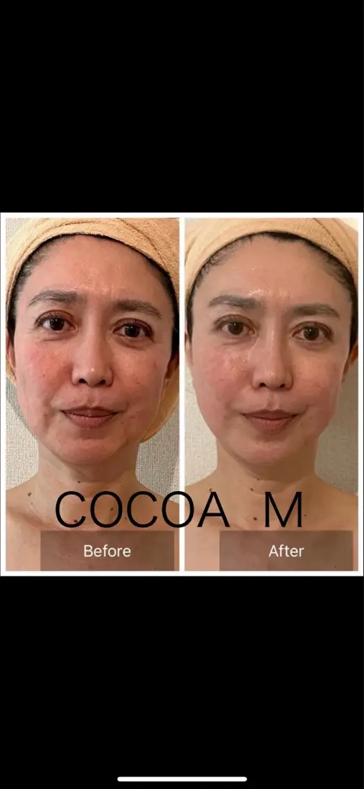 たるみへ圧倒的な結果⚠️お顔の筋肉のマッサージで−５歳へ。たるみ•ムクミ劇的改善•背中デコルテ首元＋顔筋マッサージ80分の写真