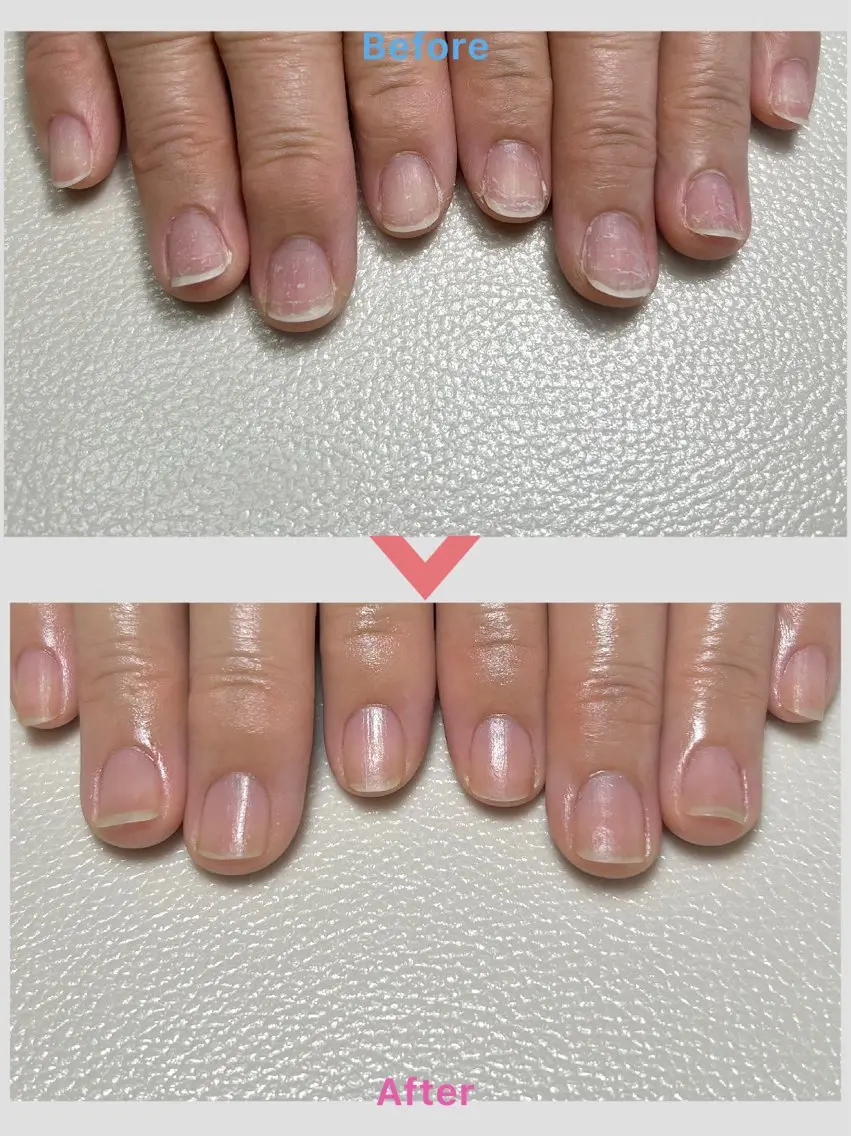 【バンド】ケアのみ　お爪の長さ、形を整えて→お湯で甘皮を柔らかくして→甘皮処理→仕上げはオイルで保湿🫧『自爪の方限定』の写真