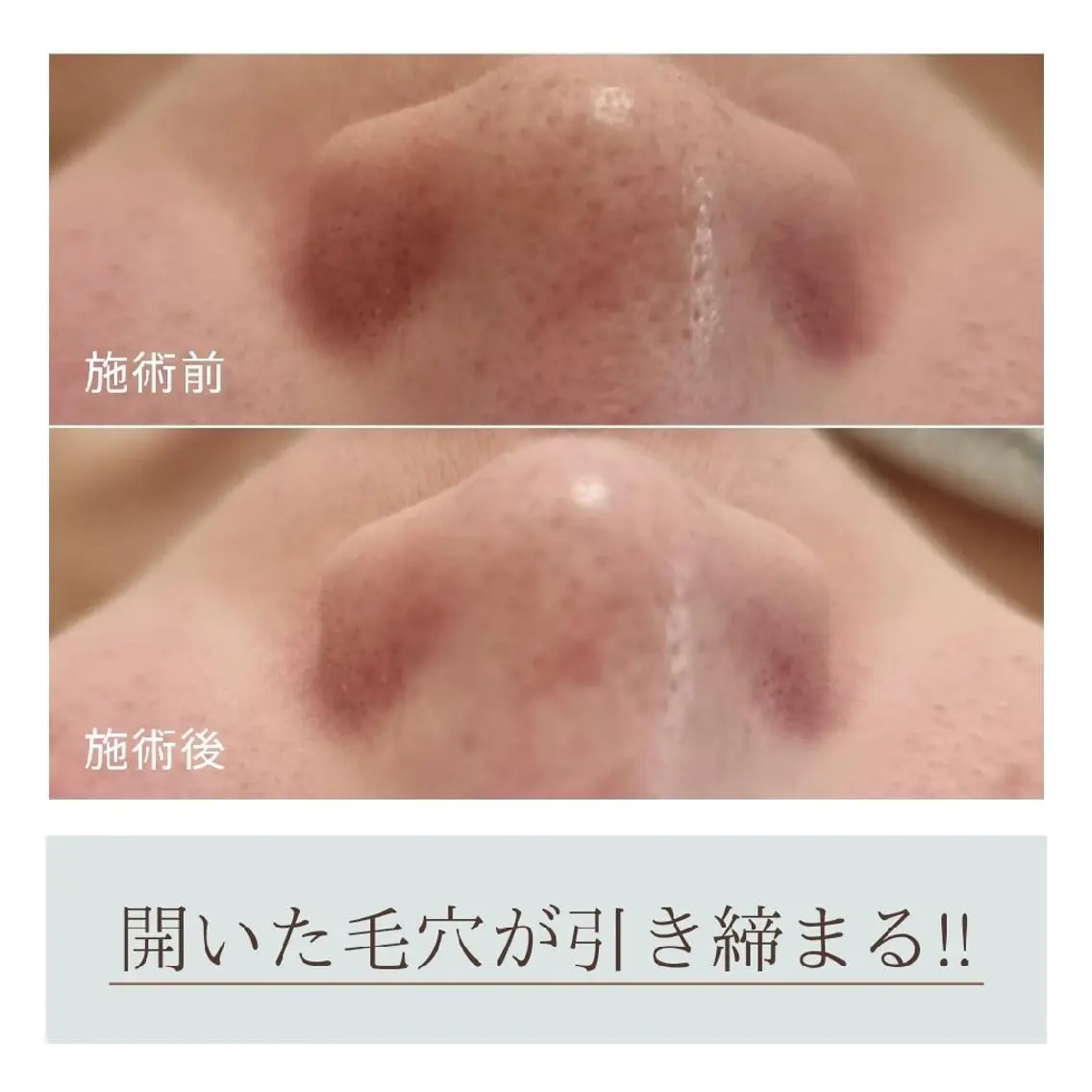 Beauty&Spa Chloe のエステ・リラクイメージ