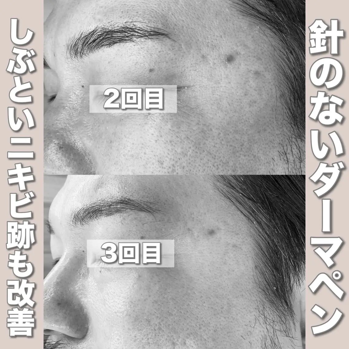 エステ mone (モーネ)のエステ・リラクイメージ