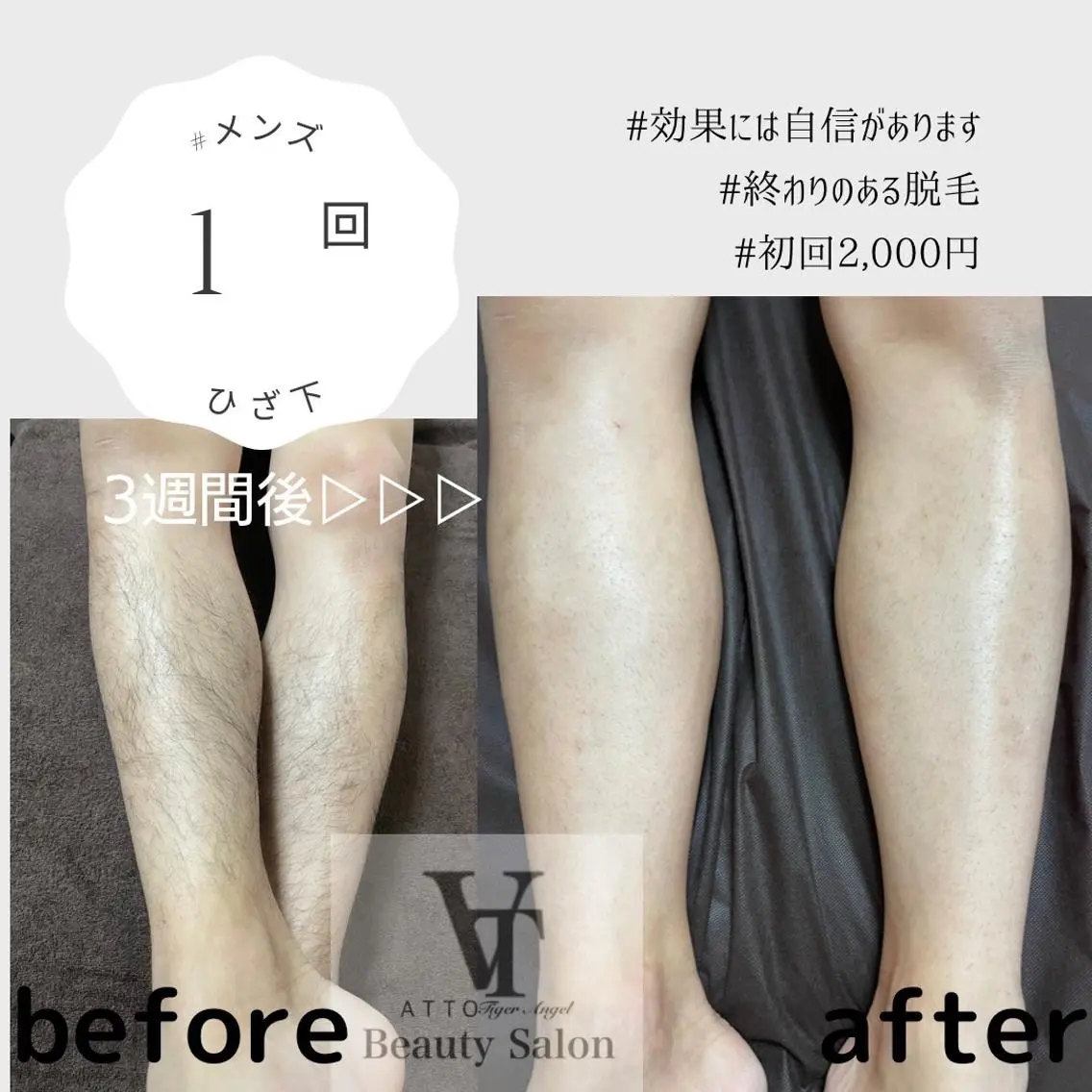 メンズ 脱毛 ATTO SHIORIのエステ・リラクイメージ